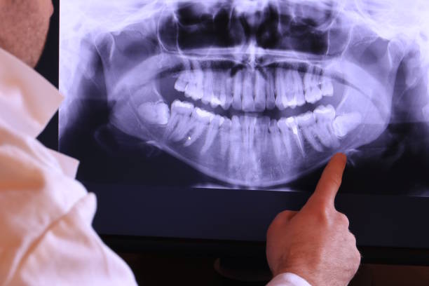 Best Emergency Dentist for Special Needs Patients in Burns Flat, OK
