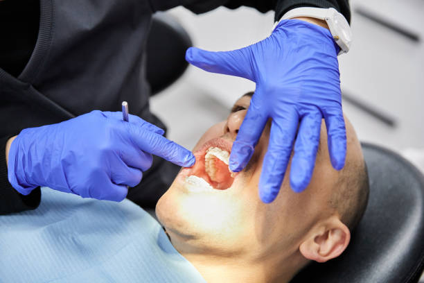 Best Emergency Dental Care for Abscessed Tooth in Burns Flat, OK